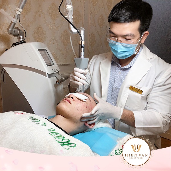 Trị sẹo rỗ bằng laser Pixel CO2