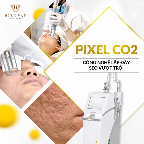 Laser Pixel vi điểm có gì khác biệt?