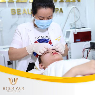 Lấy nhân mụn không thâm sẹo tại Phòng Khám Da Liễu HHV Clinic