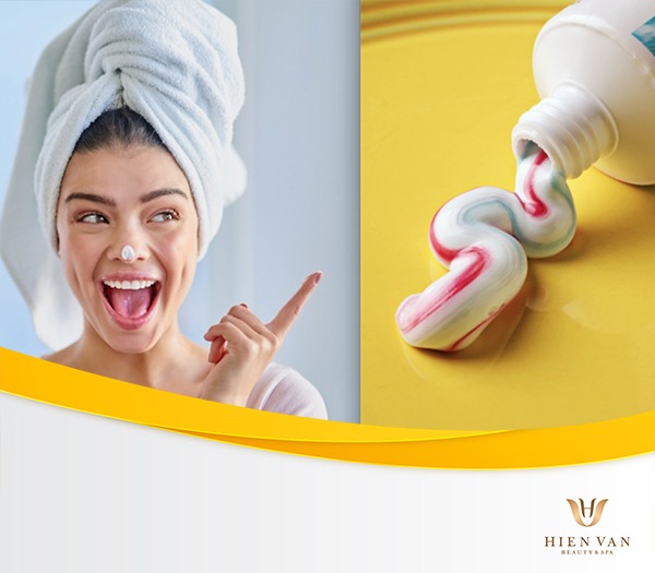 Kem đánh răng trị mụn