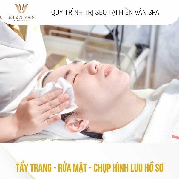 Các bước trị sẹo rỗ bằng Laser Pixel tại HHV Clinic