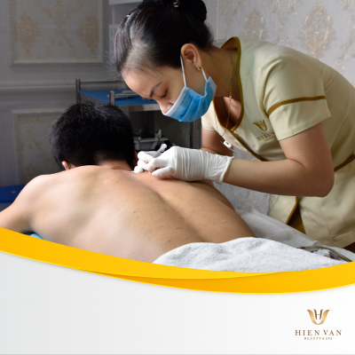 Điều trị viêm nang lông tại nhà