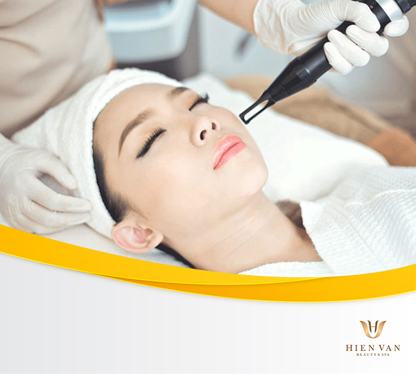 Điều trị tàn nhang bằng laser