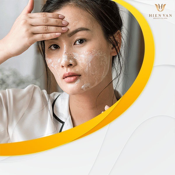 Nên lấy nhân mụn tại nhà hay nhất định phải đến Spa?