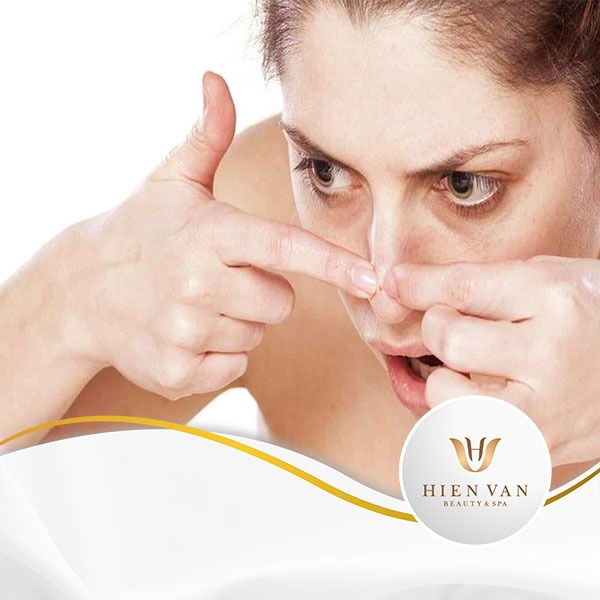 10 cách loại bỏ mụn đầu đen siêu đơn giản mà hiệu quả nhất