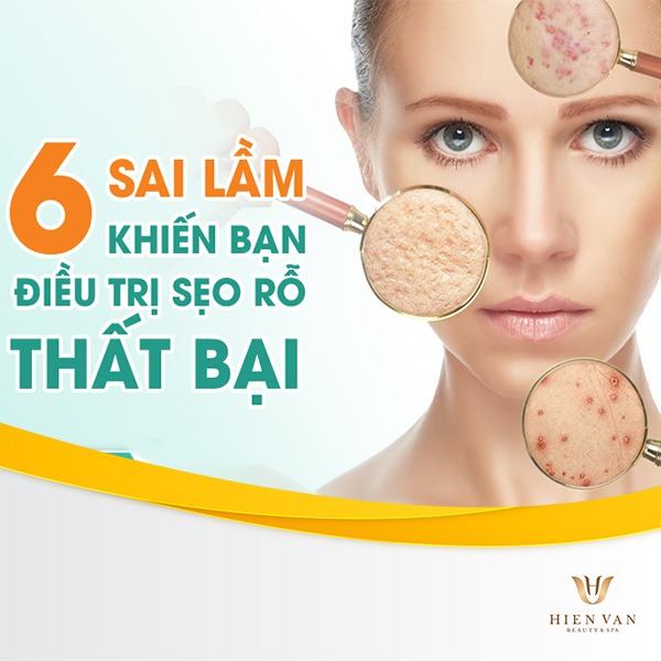 Nguyên nhân điều trị sẹo rỗ thất bại