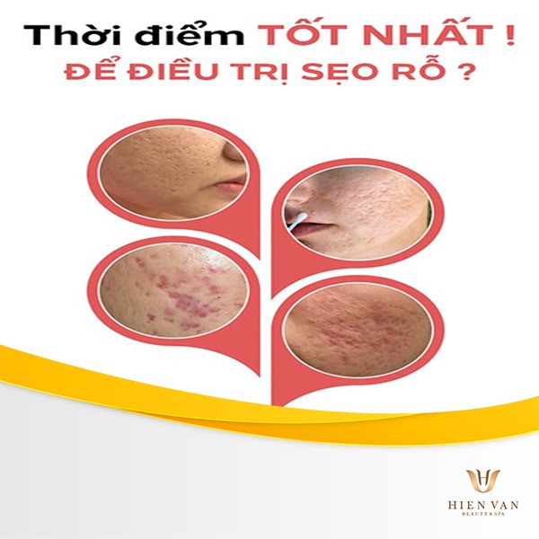 Thời điểm vàng để điều trị sẹo