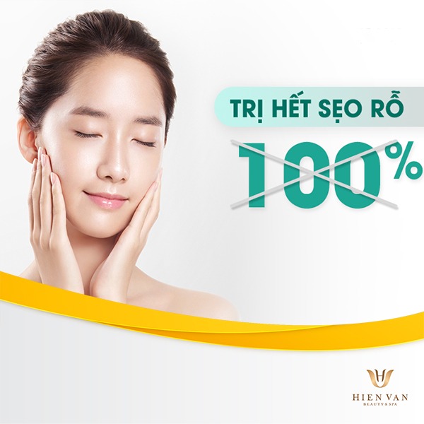 Trị sẹo rỗ không hết 100%