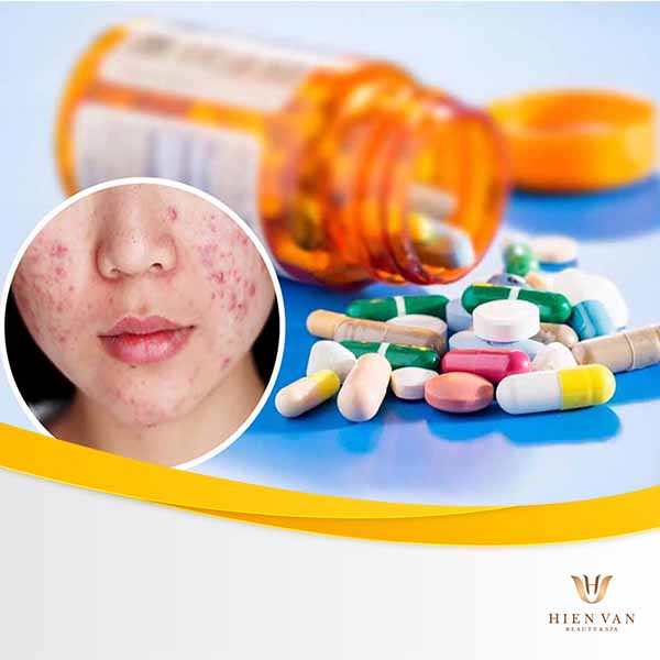 lời khuyên dùng thuốc trị mụn trứng cá từ chuyên gia