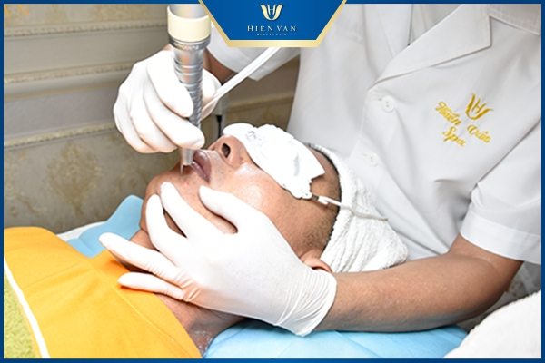 trị mụn thịt bằng Laser
