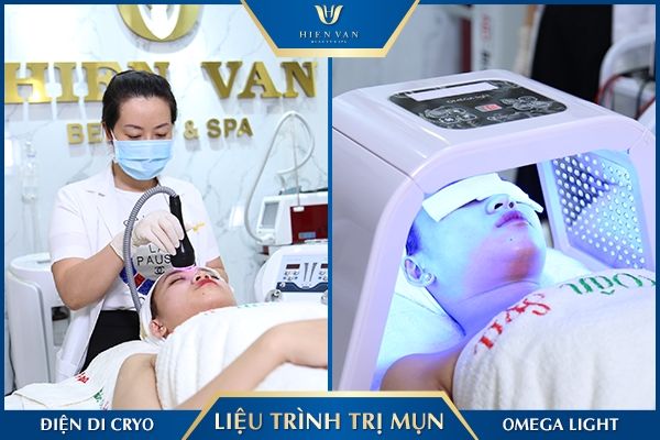cách trị mụn tận gốc