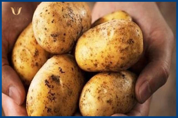 chữa thâm quầng mắt bằng khoai tây