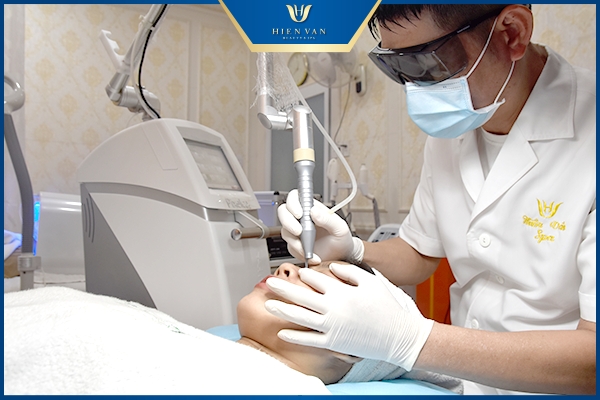 đốt mụn thịt quanh mắt bằng laser pixel