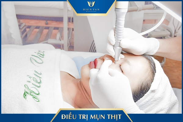 Cơ chế trị mụn thịt bằng Laser Pixel Master