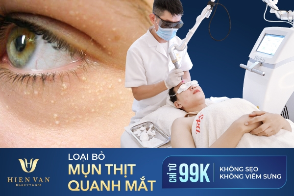 trị mụn thịt giá bao nhiêu