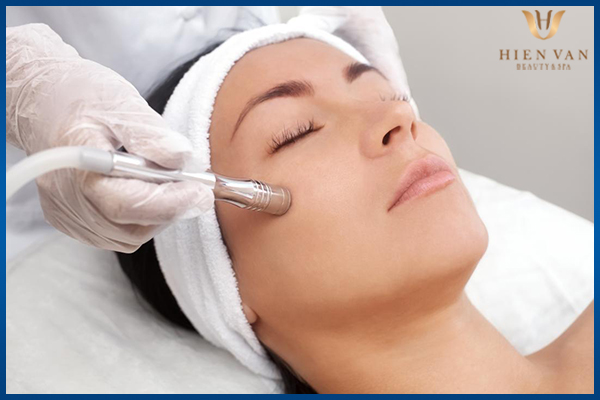 Cà da mặt làm đầy sẹo rỗ lâu năm