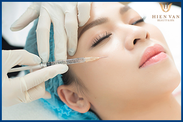Tiêm filler đầy sẹo rỗ lâu năm
