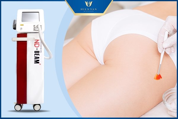 trị thâm mông bằng laser toning
