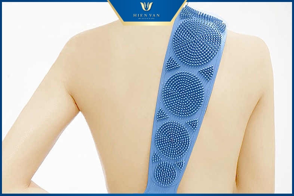 cách trị mụn lưng hiệu quả