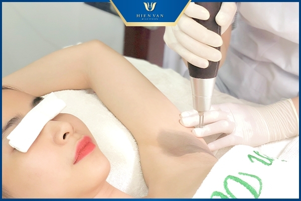 dịch vụ trị thâm nách tại HHV Clinic