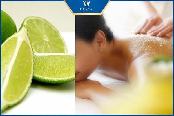 Trị mụn lưng bằng nước cốt chanh