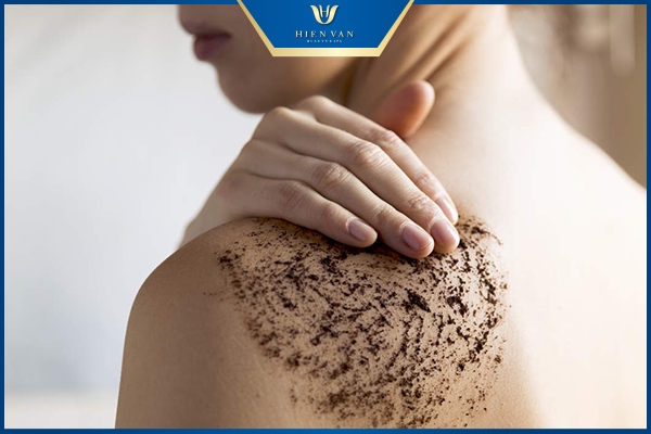 cách trị mụn ở lưng hiệu quả nhất