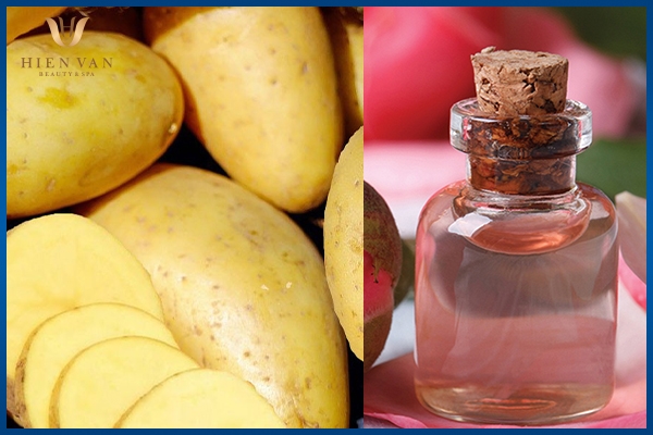 trị thâm mông hiệu quả khoai tây