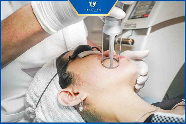 Cách trị mụn trứng cá