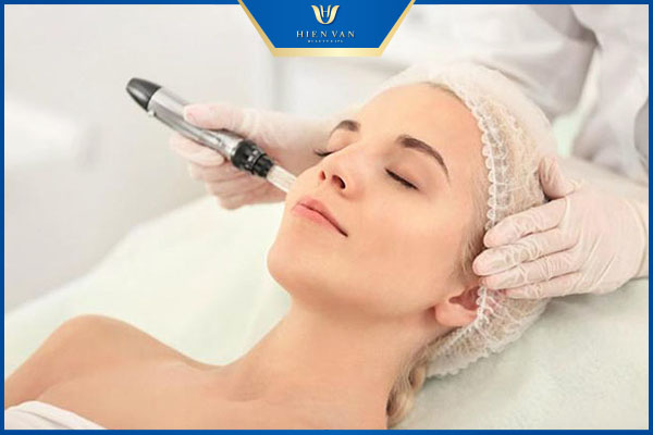 Cách trị sẹo rỗ