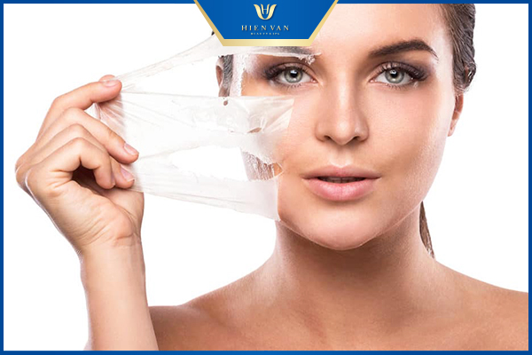 Cách trị sẹo rỗ