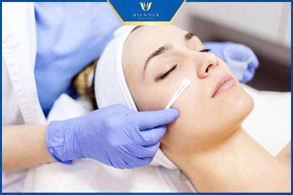 Cách trị sẹo rỗ