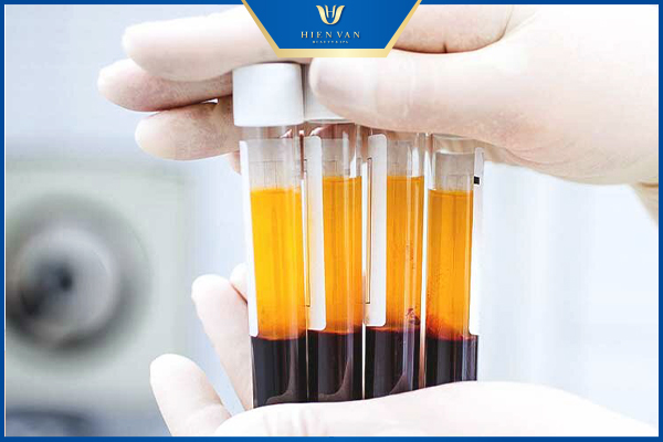 Cách trị sẹo rỗ