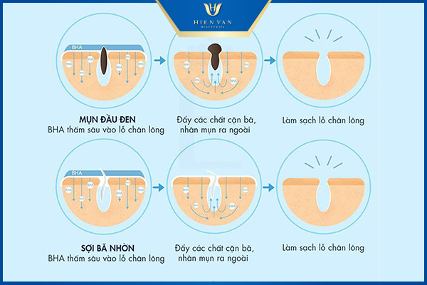 cơ chế hoạt động bha