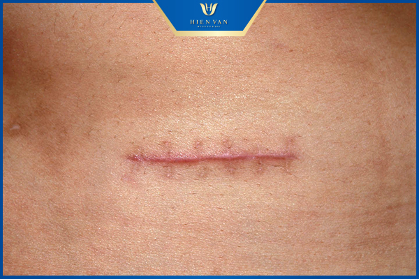 công dụng vitamin e