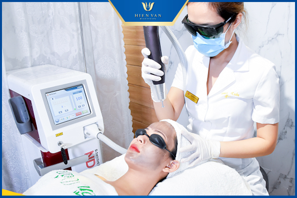 se khít lỗ chân lông bằng laser