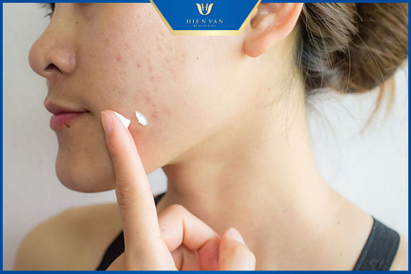 da dầu là da như thế nào