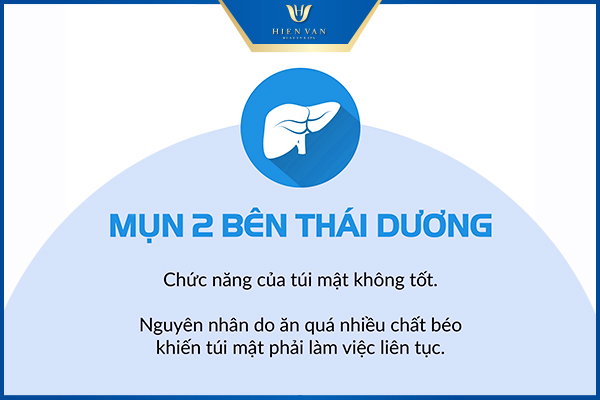 mụn 2 bên thái dương