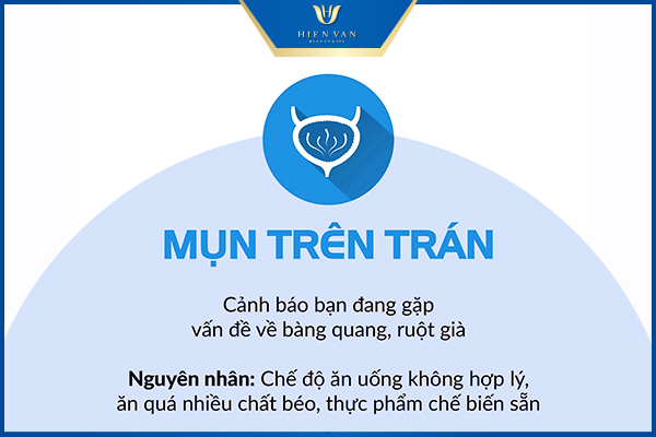 mụn trên trán