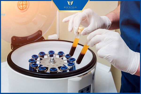 thiết bị để chiết tách PRP