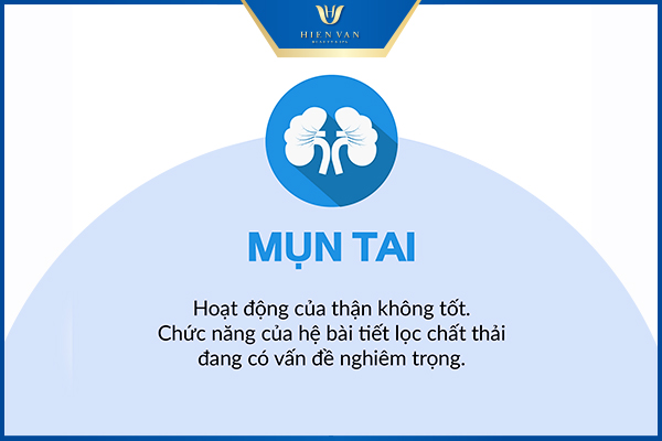 vị trí của mụn nói lên điều gì