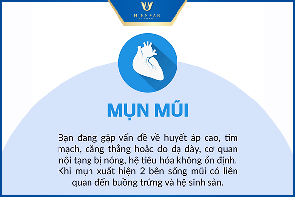 vị trí mọc mụn nói lên điều gì