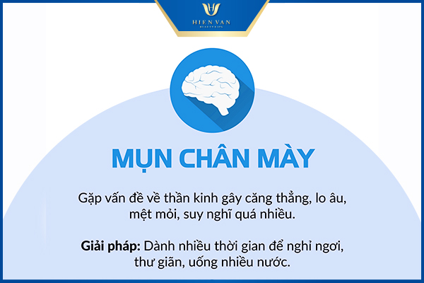 vị trí mụn nói lên điều gì
