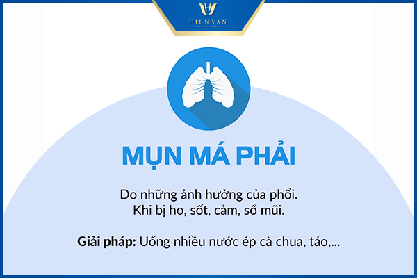 vị trí nổi mụn