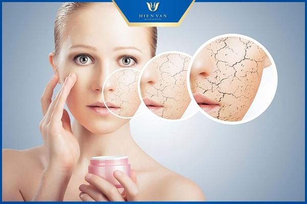 da mặt bị sạm đen chữa thế nào