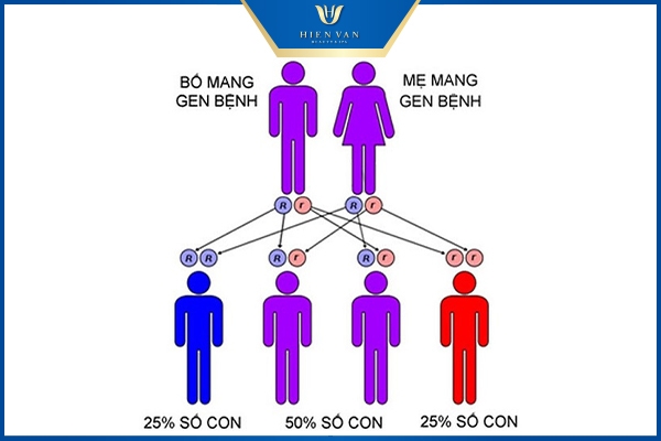 Nguyên nhân hình thành dày sừng nang lông