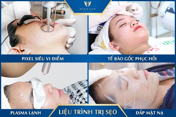 Pixel vi điểm khi trị sẹo