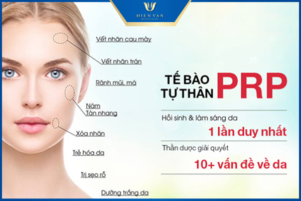 PRP làm đẹp da