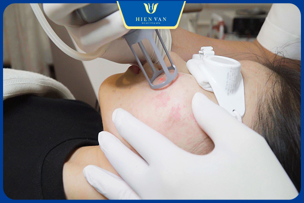 Sử dụng Pixel Master bao nhiêu lần thì hiệu quả