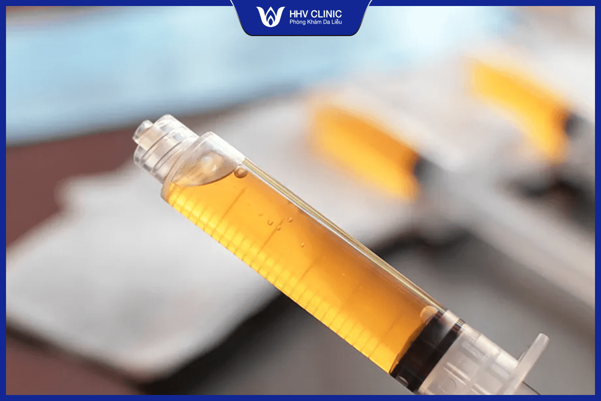 Trị liệu PRP có an toàn không