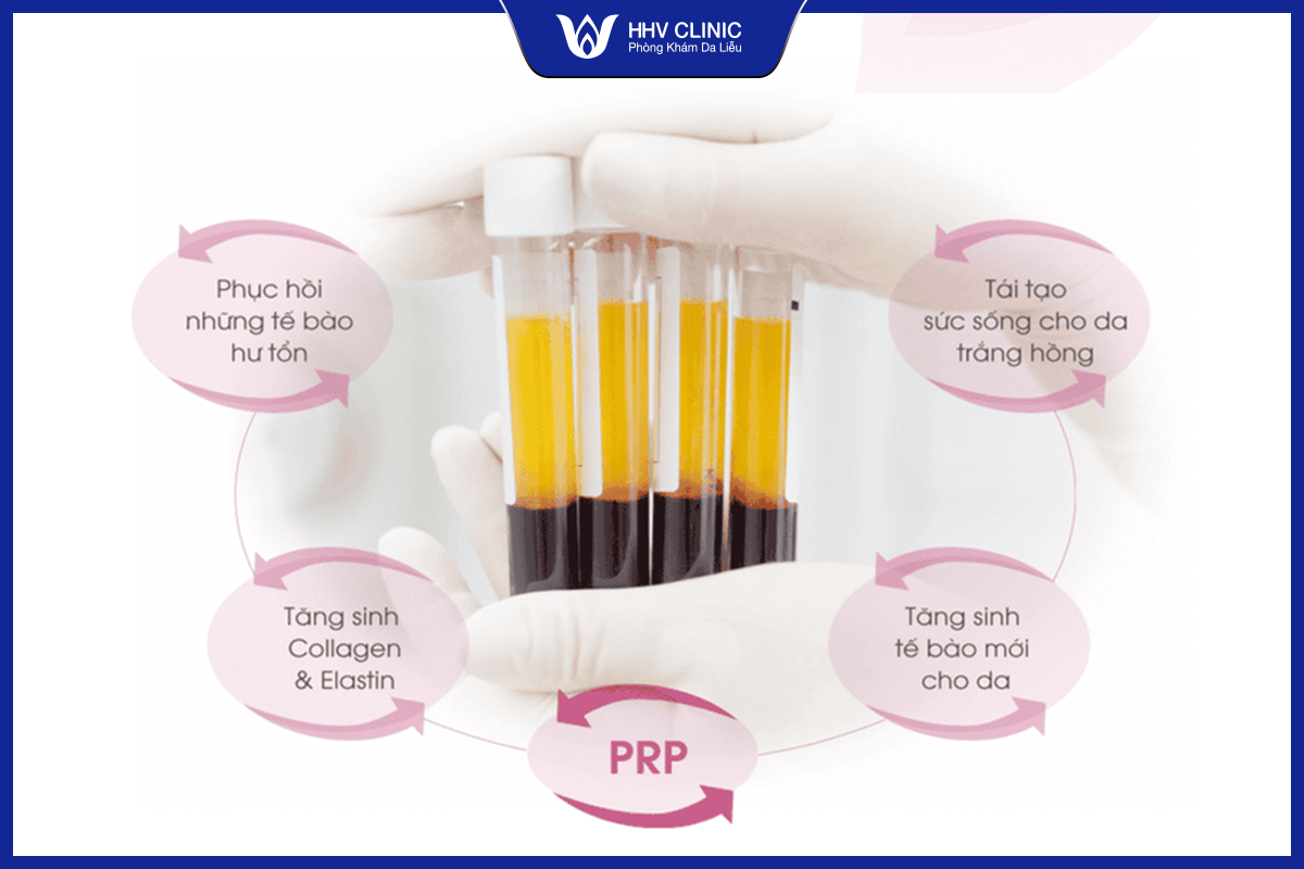 Tác dụng của PRP điều trị sẹo rỗ